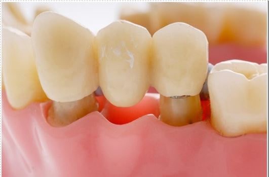 Dental exam and cleaning