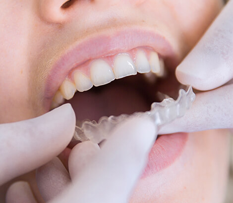 ClearCorrect in Lynnwood