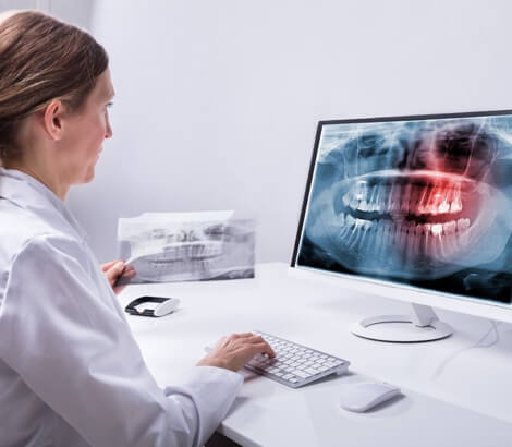 Dental X-rays in Lynnwood