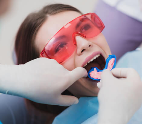 Fluoride treatments in Lynnwood