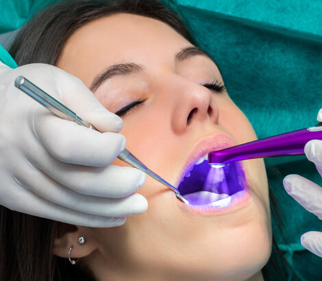 Dental sealants in Lynnwood